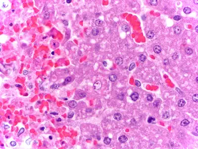 57650-Canine-herpes-virus-liver-3wo-Bulldog-puppy