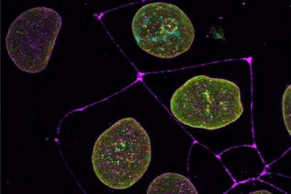 A cell nuclei