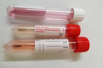 The type of viral swabs used in SARS-2-CoV testing.